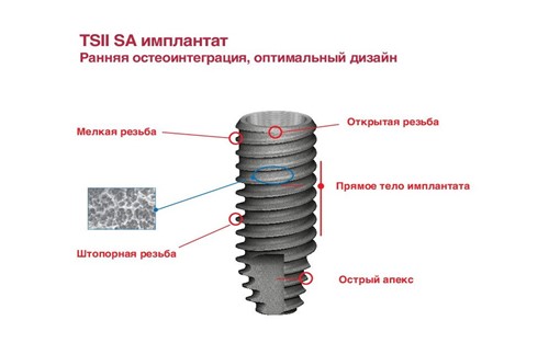 Импланты Osstem серии TS II SA Импланты Osstem серии TS II SA