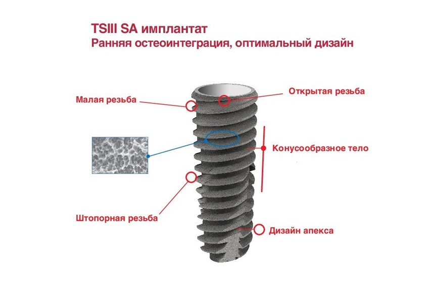 Импланты Osstem серии TS III SA Импланты Osstem серии TS III SA